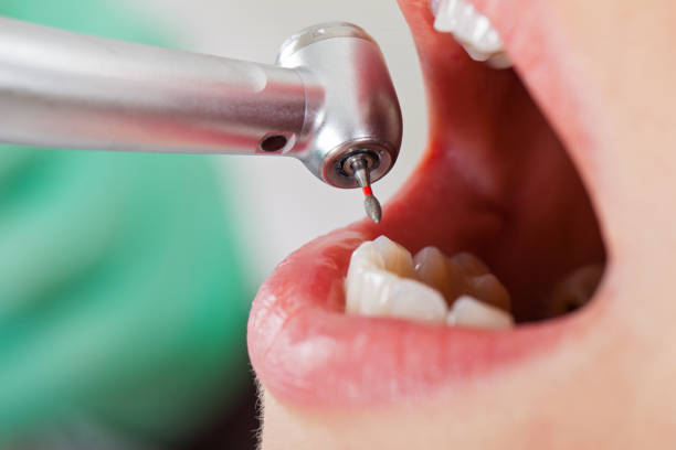 Best Knocked-Out Tooth Emergency  in Huron, SD